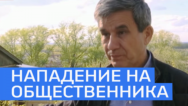 Анвер Юмагулов: нападение не повлияет на мою общественную деятельность 
