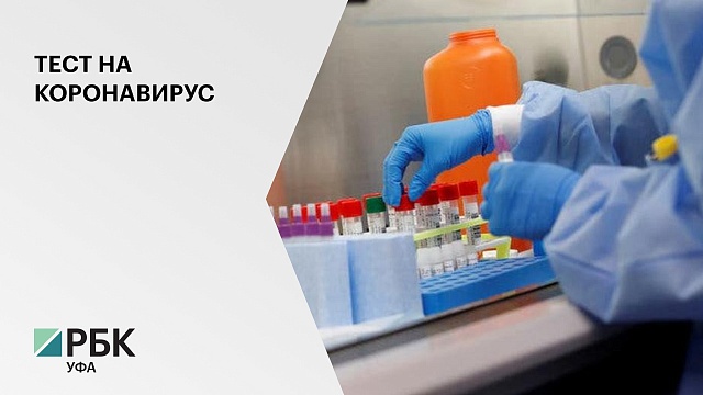 Стоимость тестов на коронавирус в частных лабораториях Уфа составляет от 1200 руб. до 1900 руб.